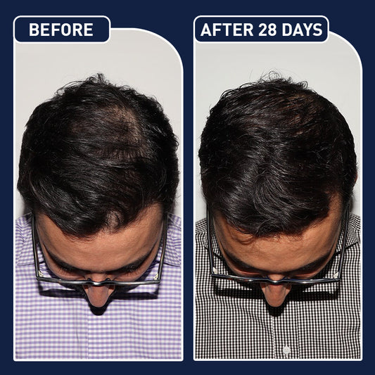 FEG Plus Hair Growth Spray (Original)